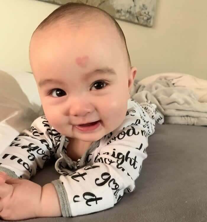 Heart Shaped Birthmark