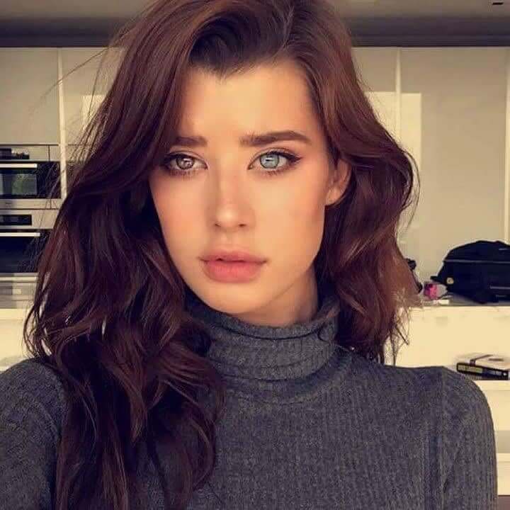 Heterochromia Made Her Famous