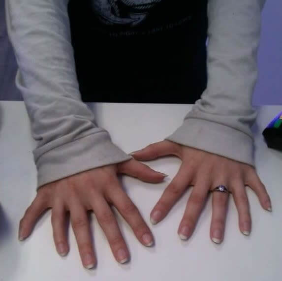 Six-Fingered Hands