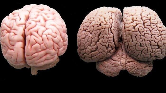 Remarkable 3D Scans of Human Brain Vs. Dolphin Brain
