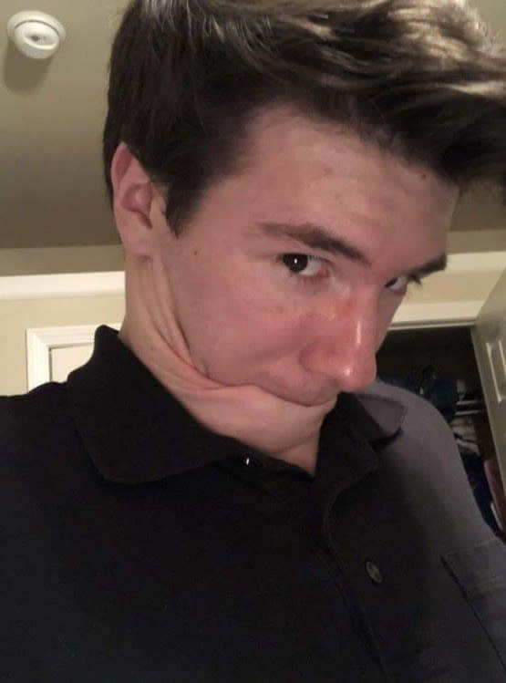 Very Stretchy Neck Skin