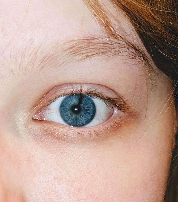 Black Line In A Blue Iris