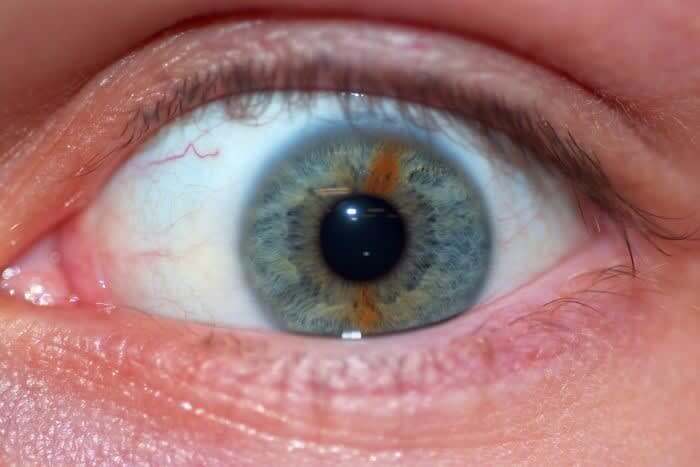 Stripe Through The Iris
