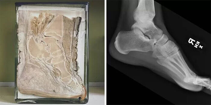 The Gigantic Differences in An Elephant Foot Vs. Human Foot