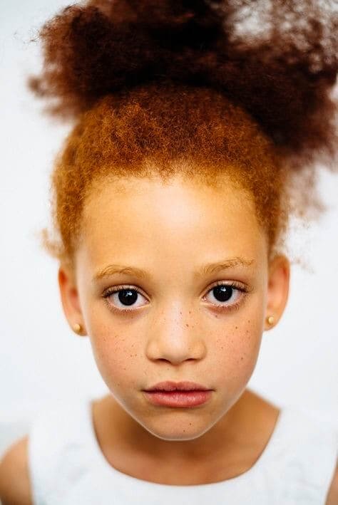Red Hair In People Of African Descent