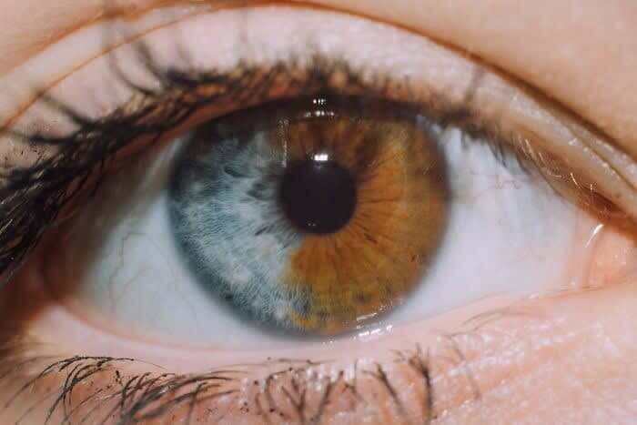 Split Iris