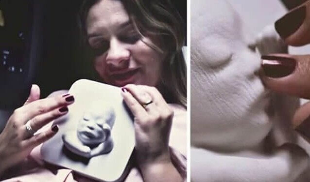 Blind Parents Can "See" Their Baby's Ultrasounds for the First Time